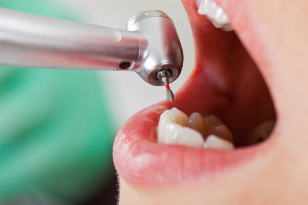 Best Emergency Cosmetic Dentistry (e.g., broken veneers) in USA